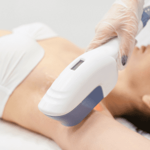 Dai Chinese Laser Hair Removal